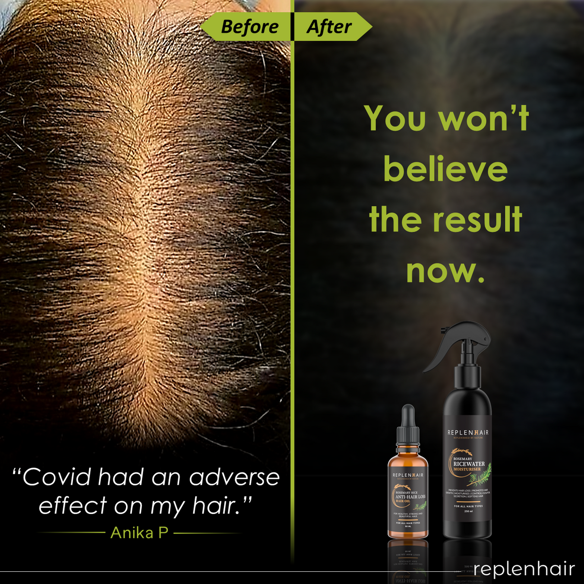 Rosemary Rice Water Anti - Hair Loss Bundle