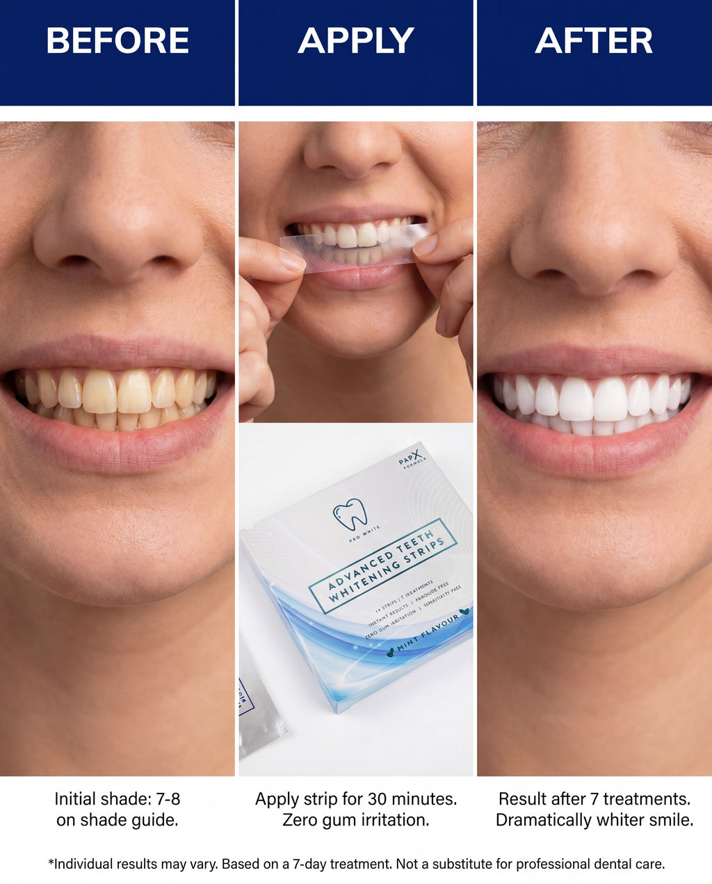 PAP - X™ Advanced Teeth Whitening Strips