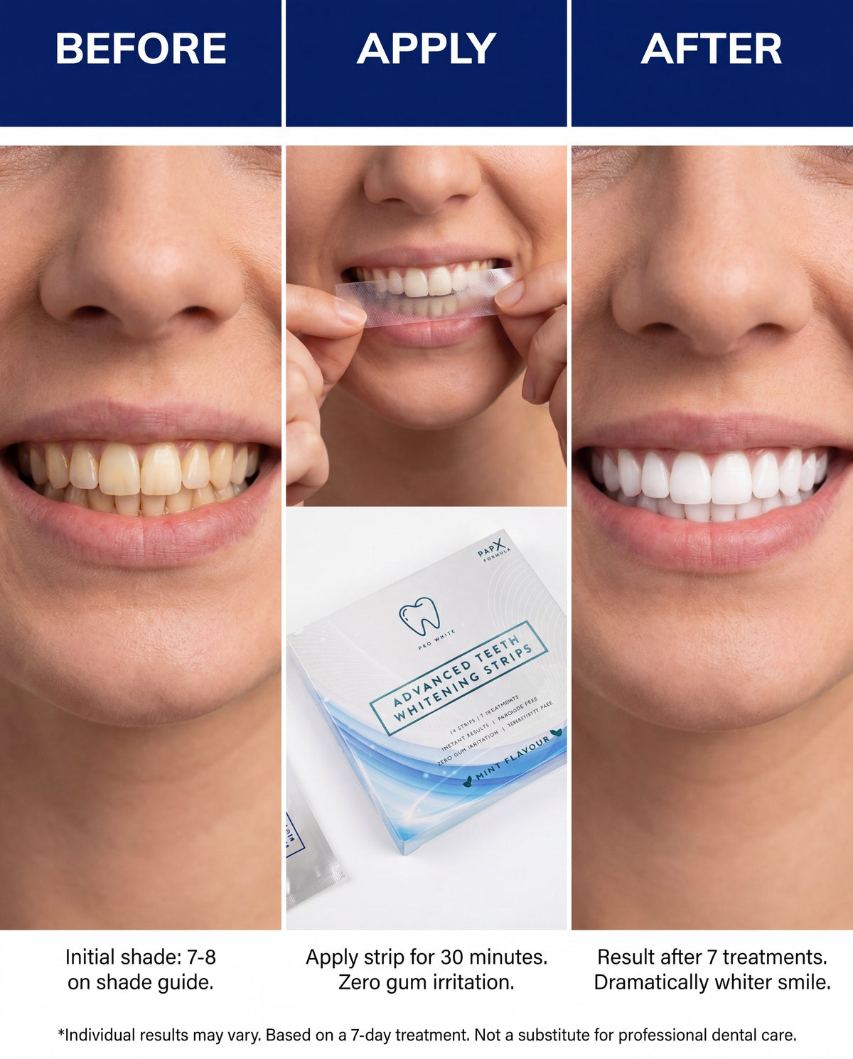 PAP - X™ Advanced Teeth Whitening Strips