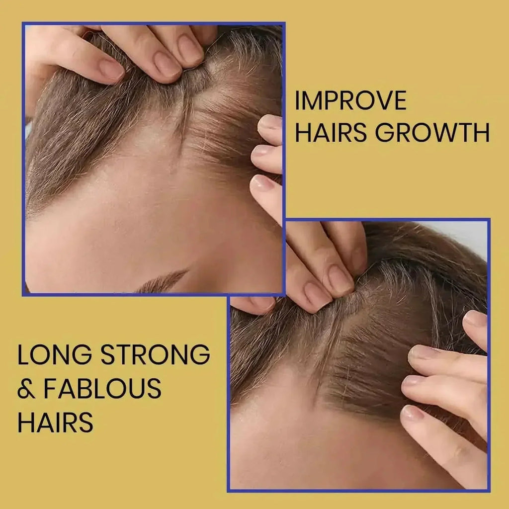 Biotin Shampoo for Hair Thinning